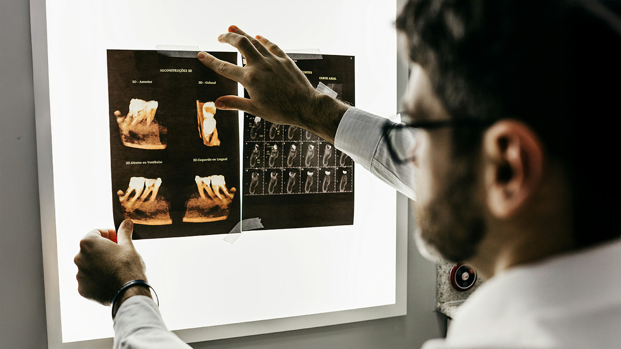 A doctor is looking at the X-ray of the teeth 