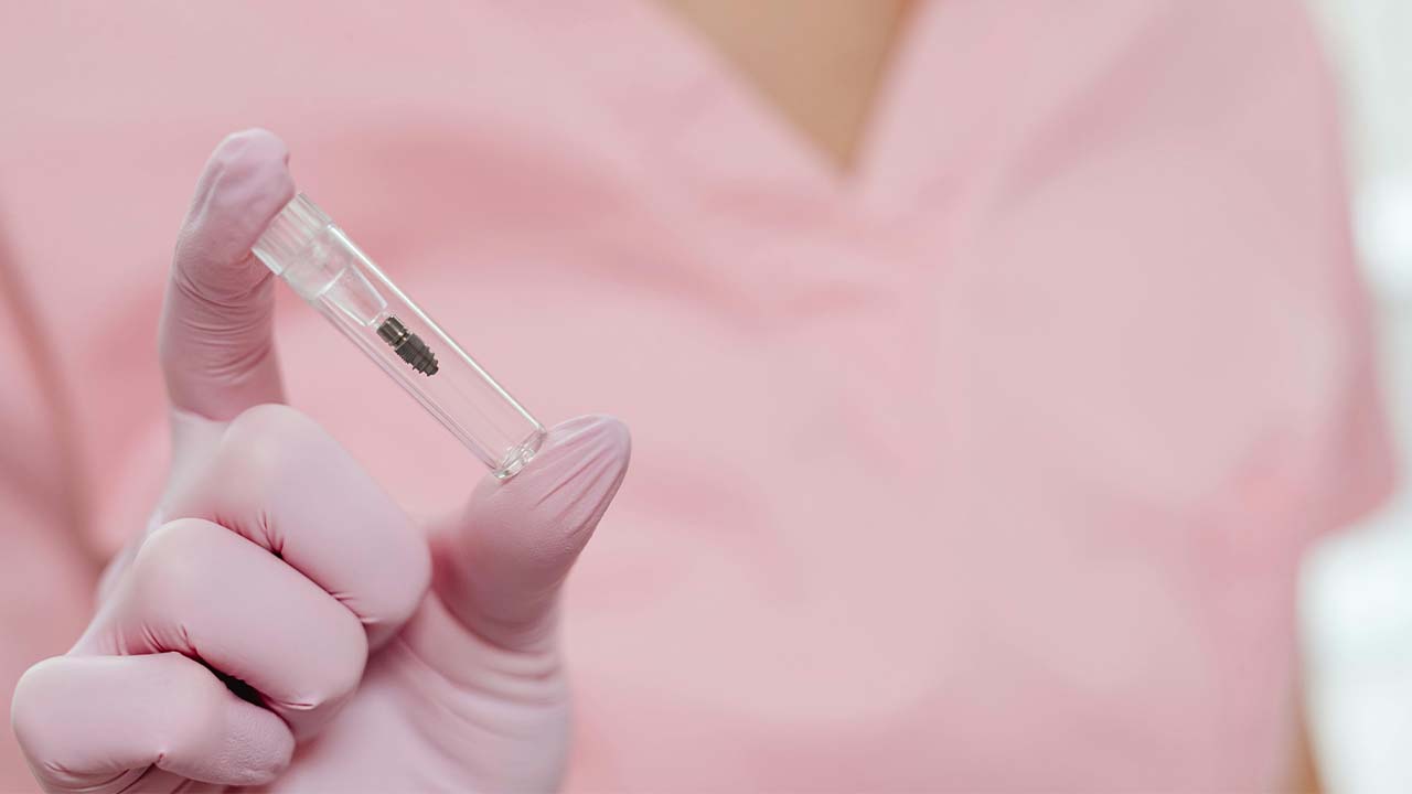 A photo of a dental implant placed in a sterile vial held by a person