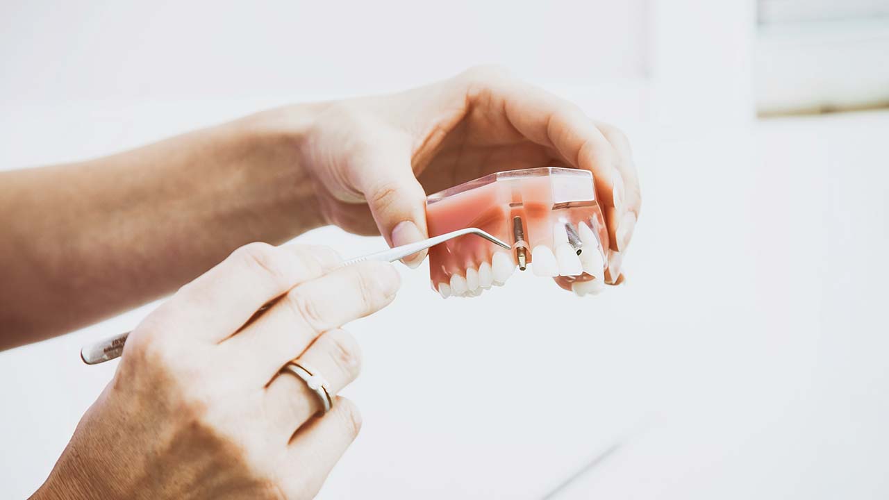In the doctor's hand, we can see a dental prosthesis and the dental implant procedure